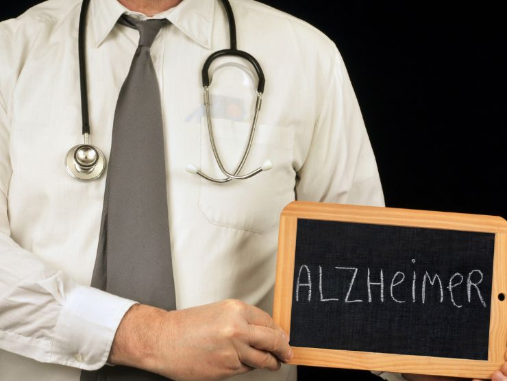 Ricerca Alzheimer cosa si è scoperto
